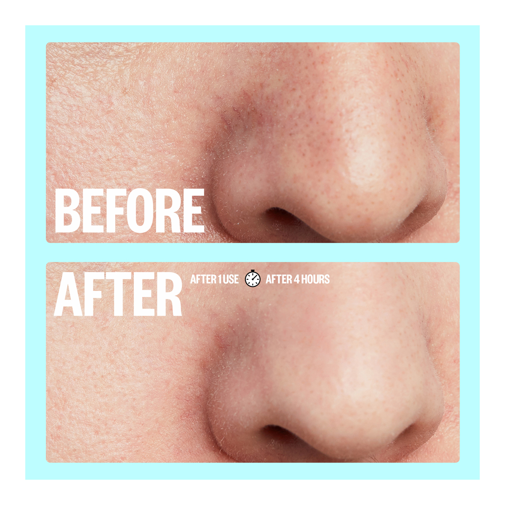 Pores - 8 Pieces