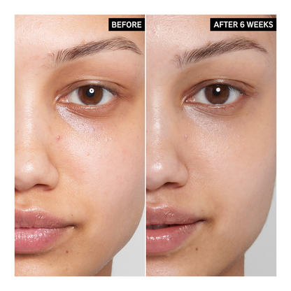 Caffeine Under-Eye Cream - 15ml