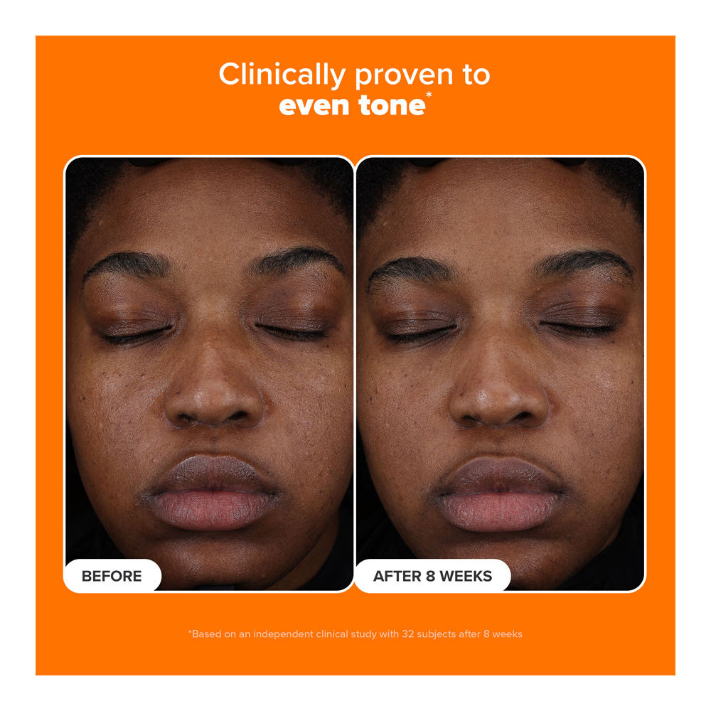 25% Vitamin C + Glutathione Clinical Serum - 30ml