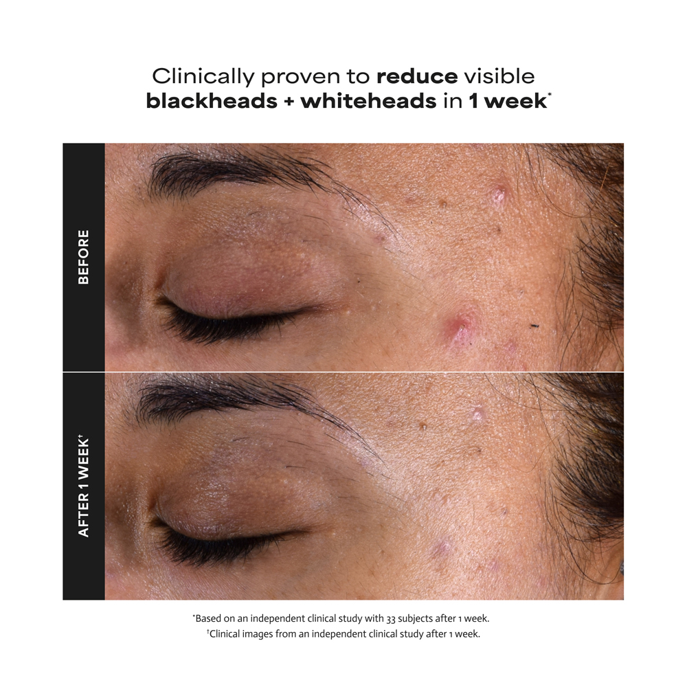 Skin Perfecting 2% BHA Liquid Exfoliant - 118ml