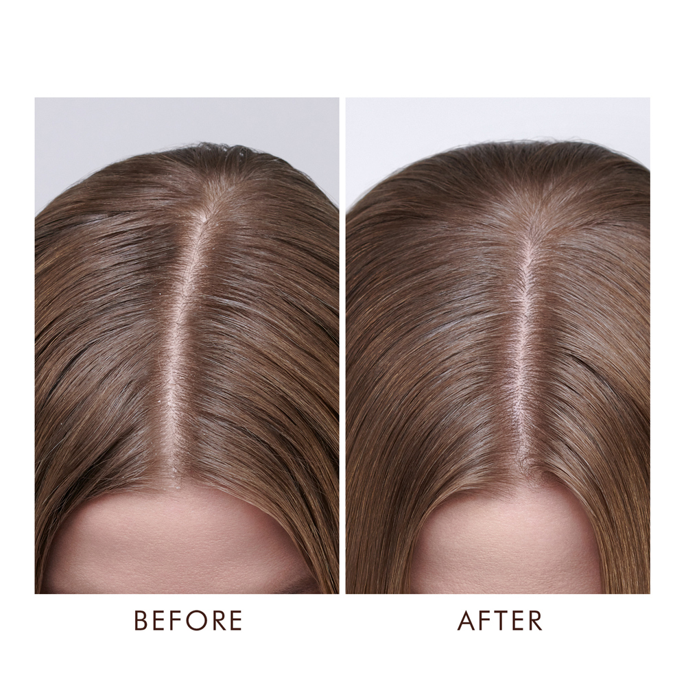 Dry Scalp Treatment - 45ml