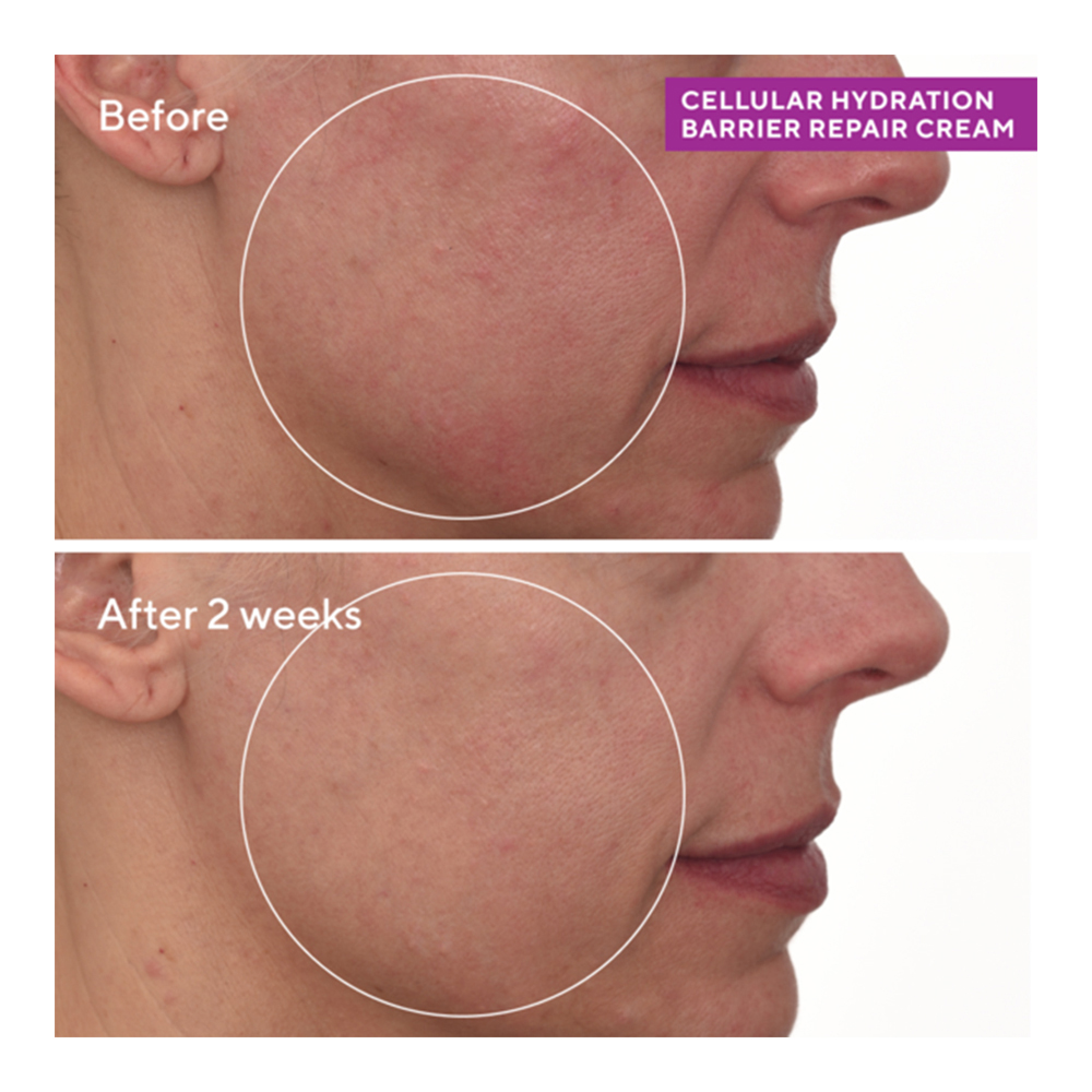 Cellular Hydration Repair Cream - 50ml