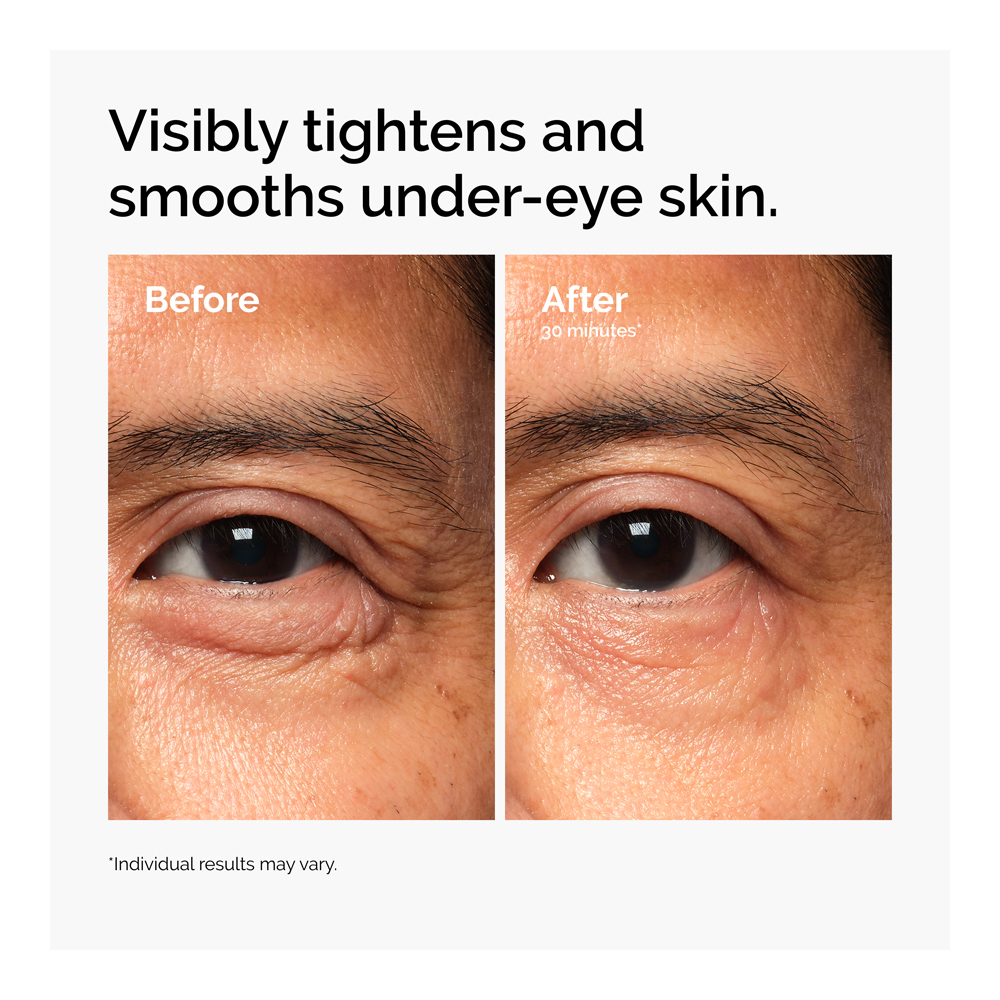 Lacto-PDRN* 4% + B9 Eye Cream - 15ml