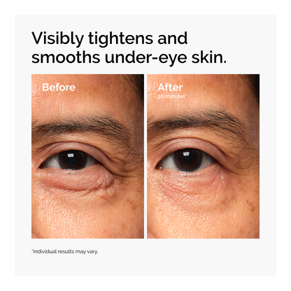 Lacto-PDRN* 4% + B9 Eye Cream - 15ml
