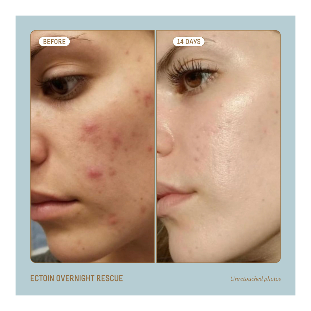 Squalane + Ectoin Overnight Rescue Ultra-Rich Cream - 50ml