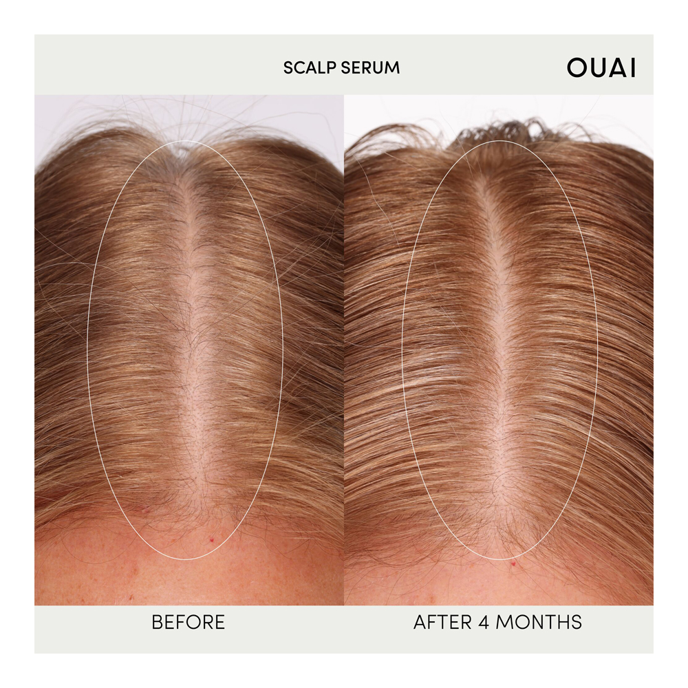 Scalp Serum - 60ml