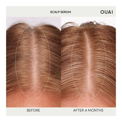 Scalp Serum - 60ml