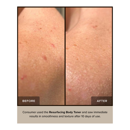 Nudebody Resurfacing Body Toner - 150ml