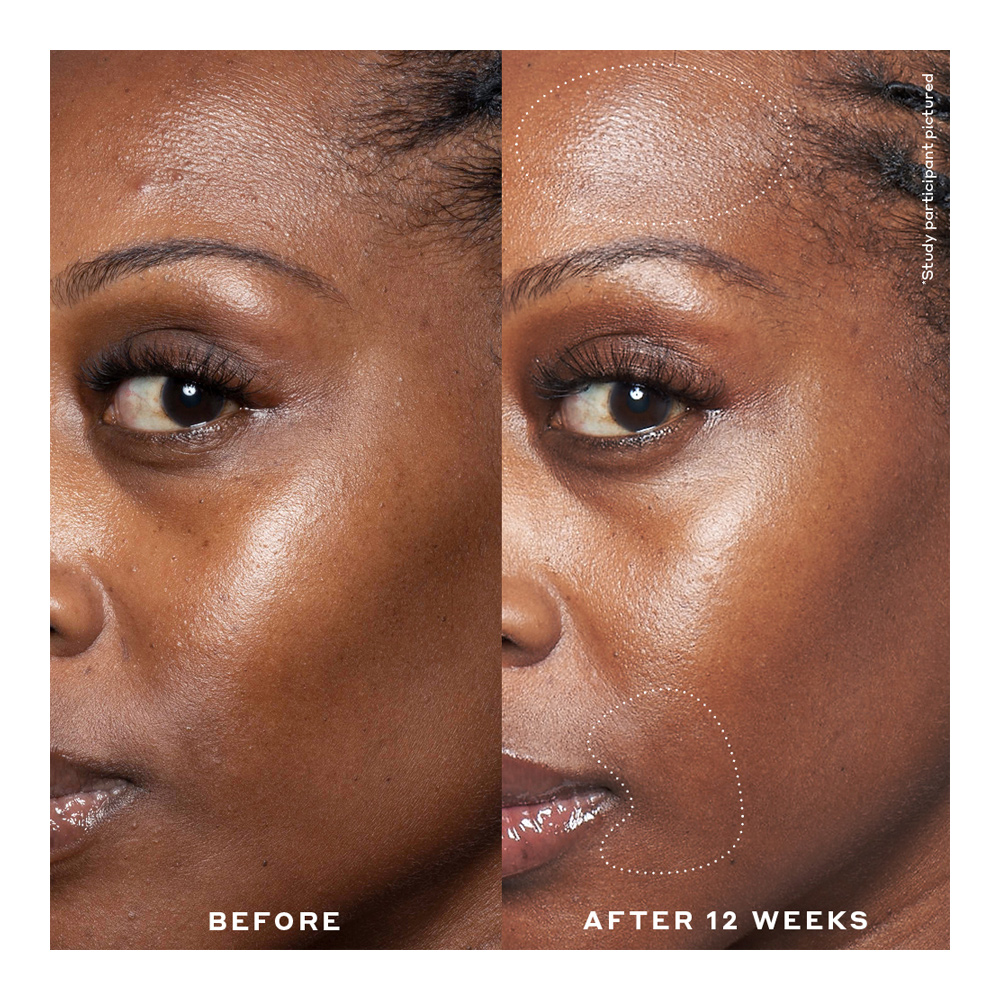 Transform Double Rewind Pro-Grade 0.3% Retinol Serum - 30ml