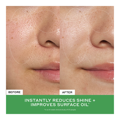 Detox Drops 2% Salicylic Acid Anti-Blemish Toner - 120ml