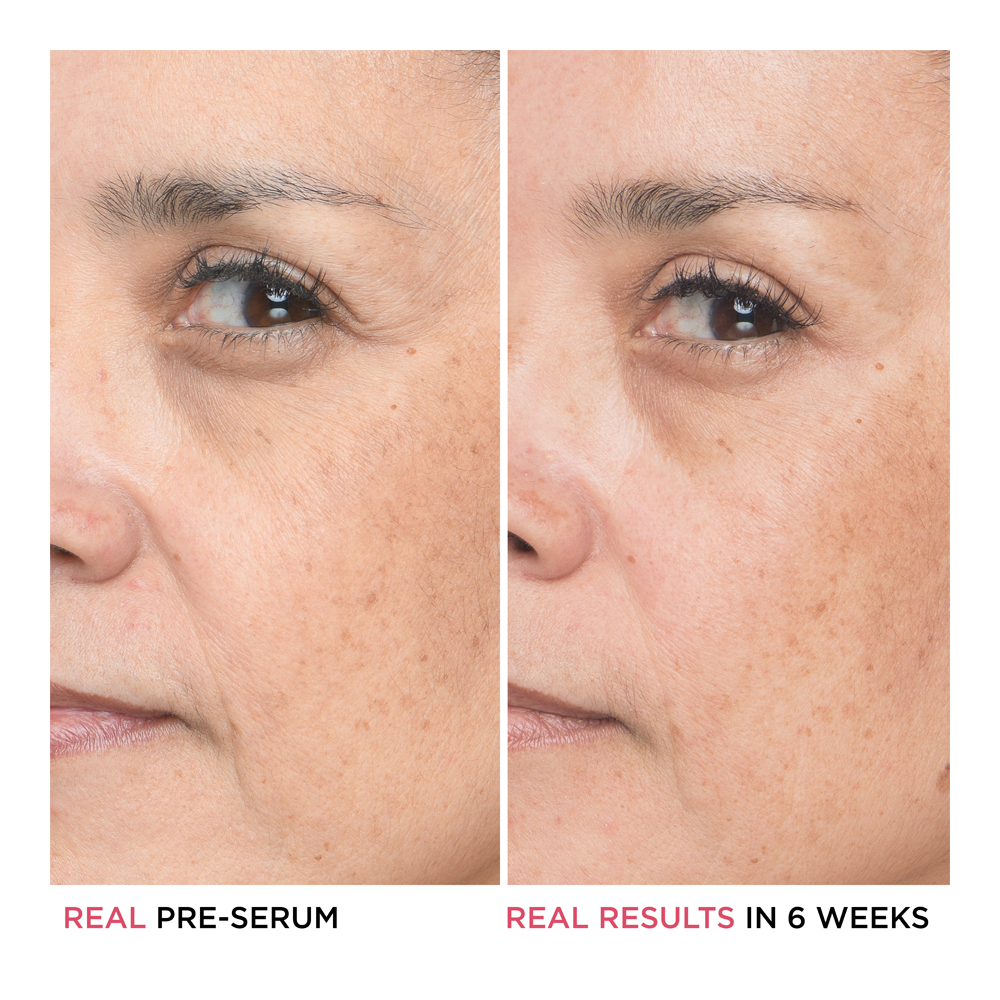 Bye Bye Lines Hyaluronic Acid Serum - 30ml